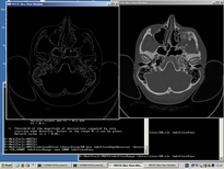 MDSTk Snapshot 5