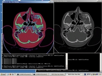 MDSTk Snapshot 6